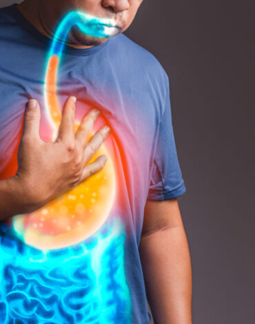heartburn relief